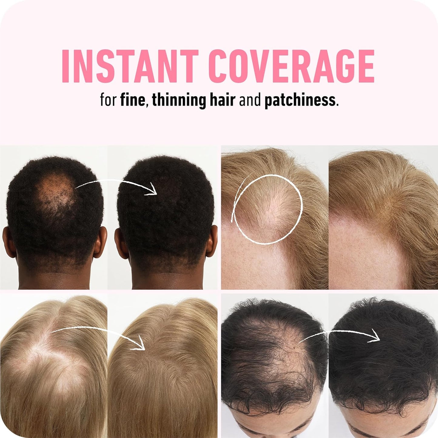 Growthz Hair Building Fibers 28g - Instant Thickening for Thinning Hair - Natural Look for Men & Women - Conceals Bald Spots & Hair Loss - Long Lasting & Sweat Resistant