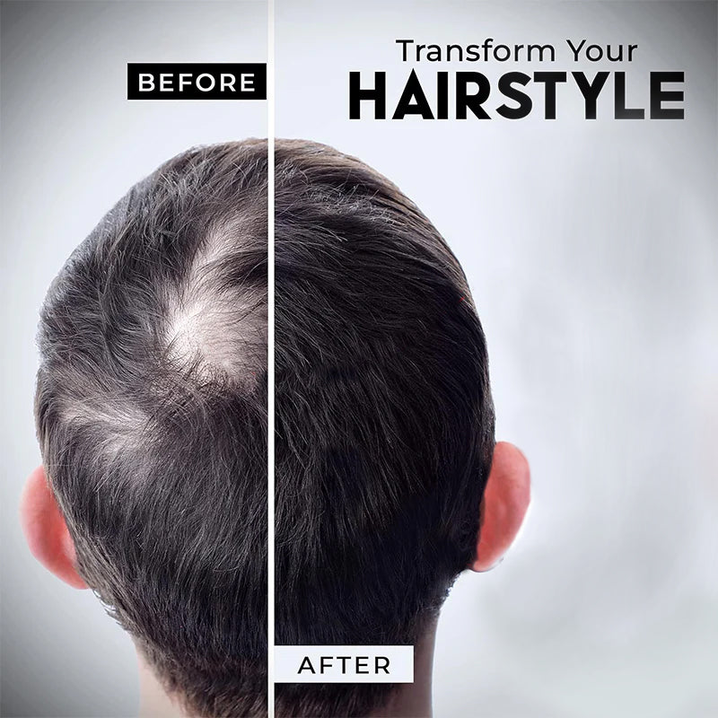 Growthz Hair Building Fibers 28g - Instant Thickening for Thinning Hair - Natural Look for Men & Women - Conceals Bald Spots & Hair Loss - Long Lasting & Sweat Resistant
